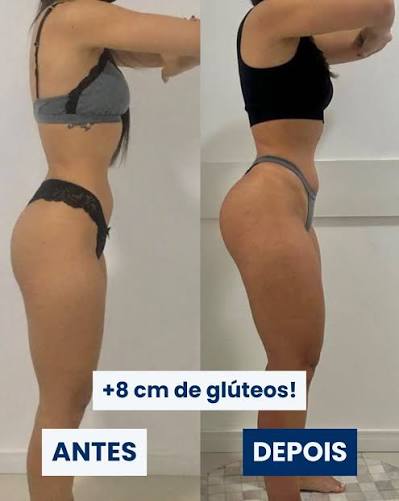 Antes e depois — resultado real em glúteos